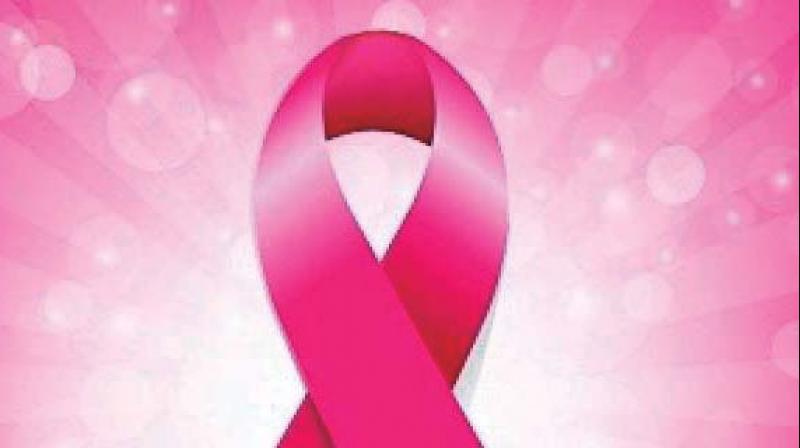 New radiation therapy to reduce chances of breast cancer relapse