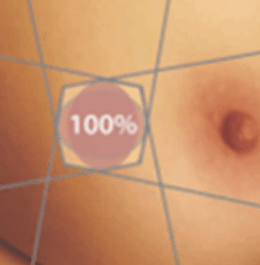 Oncology